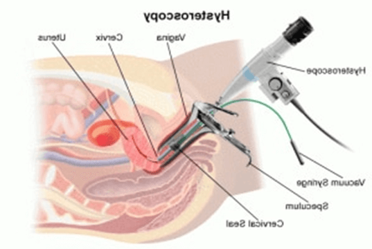 Best Laparoscopic surgeon in pune