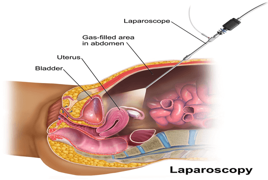 Best Laparoscopic surgeon in pune